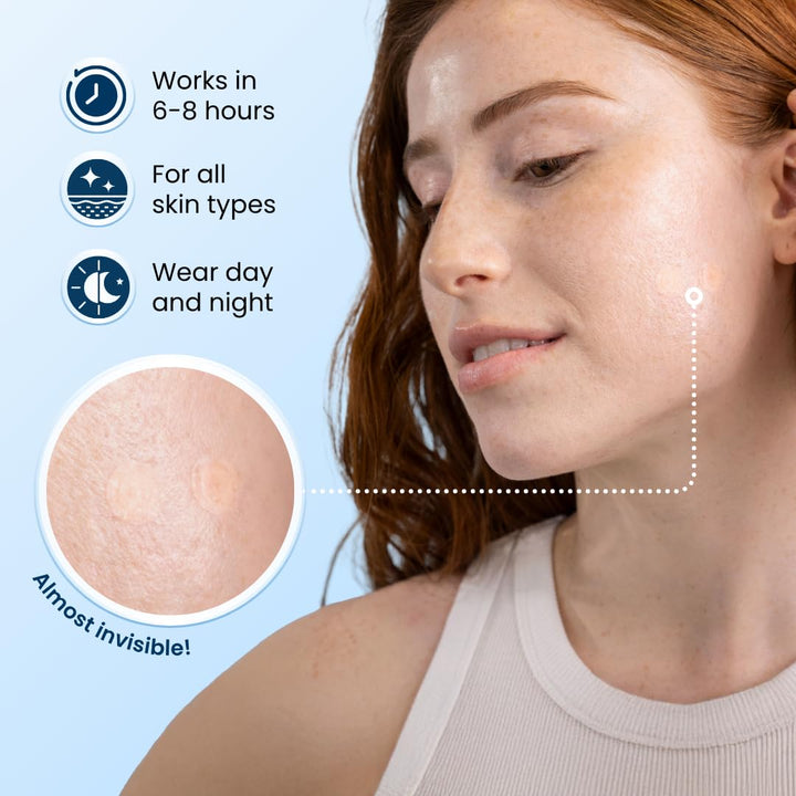 CLEAN SKIN CLUB 60 Invisible Vegan Pimple Patches, Derma Dot Hydrocolloid for Covering Zits, Blackhead, Blemish, Absorbing Face Cover Sticker, Skincare Treatment, Non Toxic Ingredients