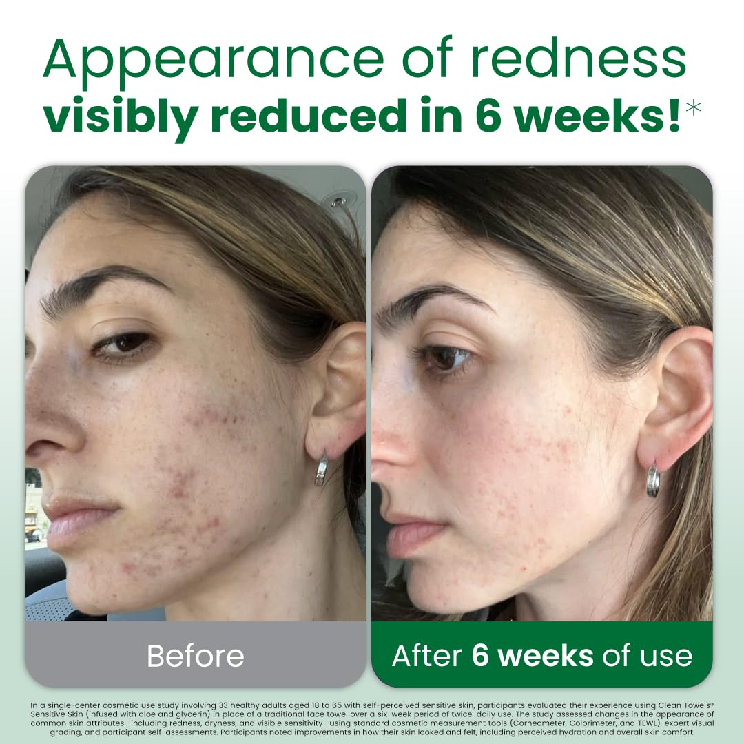 CLEAN SKIN CLUB Sensitive Skin Clean Towels® XL, Ultra-Soft Disposable Face Dry Wipes Infused with Aloe &amp; Glycerin, XL - 1 Pack (50 count)