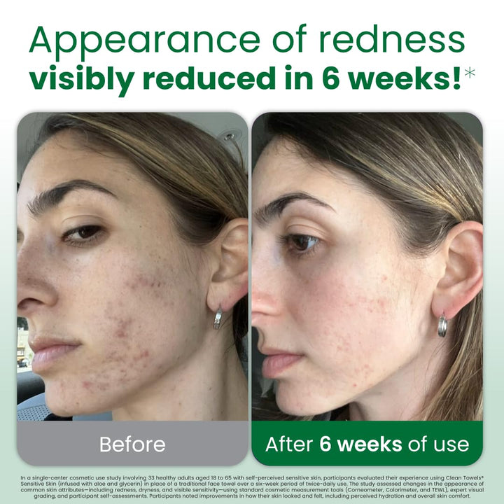 CLEAN SKIN CLUB Sensitive Skin Clean Towels® XL, Ultra-Soft Disposable Face Dry Wipes Infused with Aloe &amp; Glycerin, XL - 1 Pack (50 count)