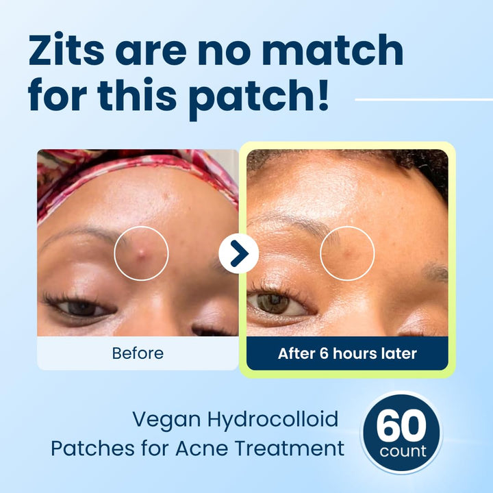 CLEAN SKIN CLUB 60 Invisible Vegan Pimple Patches, Derma Dot Hydrocolloid for Covering Zits, Blackhead, Blemish, Absorbing Face Cover Sticker, Skincare Treatment, Non Toxic Ingredients