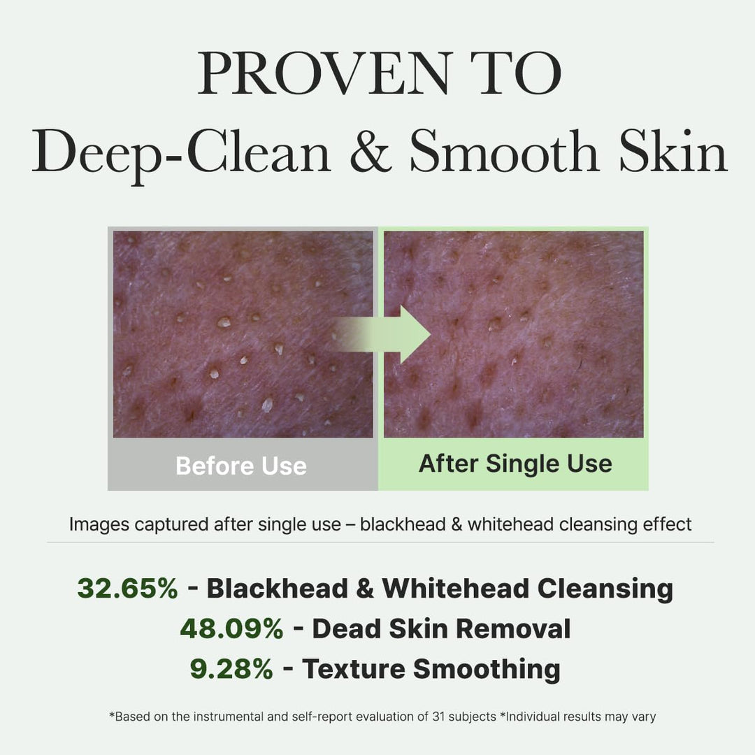 Arencia Korean Rice Mochi Face Cleanser - Face Wash, Gentle Scrub All in One for Deep Cleansing, Moisturizing, Pore Minimizing, Acne-Prone Skin, Removing Blackhead with Rice Water &amp; Green Tea