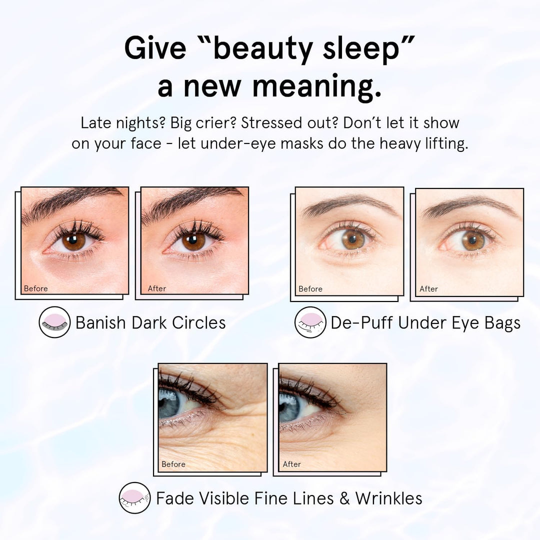 grace &amp; stella Retinol Under Eye Patches for Puffy Eyes &amp; Dark Circles - Restoring Gel Under Eye Masks with Hyaluronic Acid - Birthday Gifts for Women, Bachelorette Party Favors (Purple, 24 Pairs)