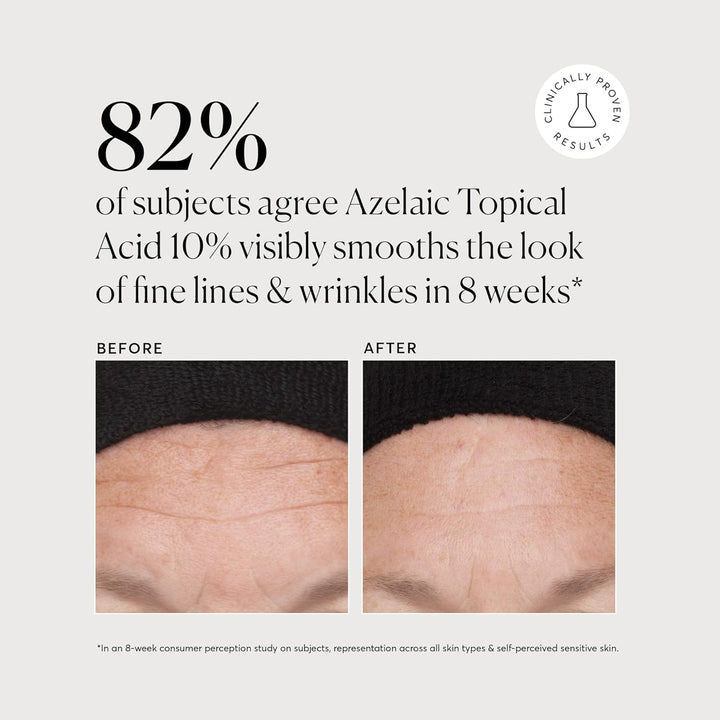Naturium Azelaic Topical Acid 10%, Face &amp; Skin Care Beauty Treatment with Niacinamide &amp; Vitamin C, 1 oz