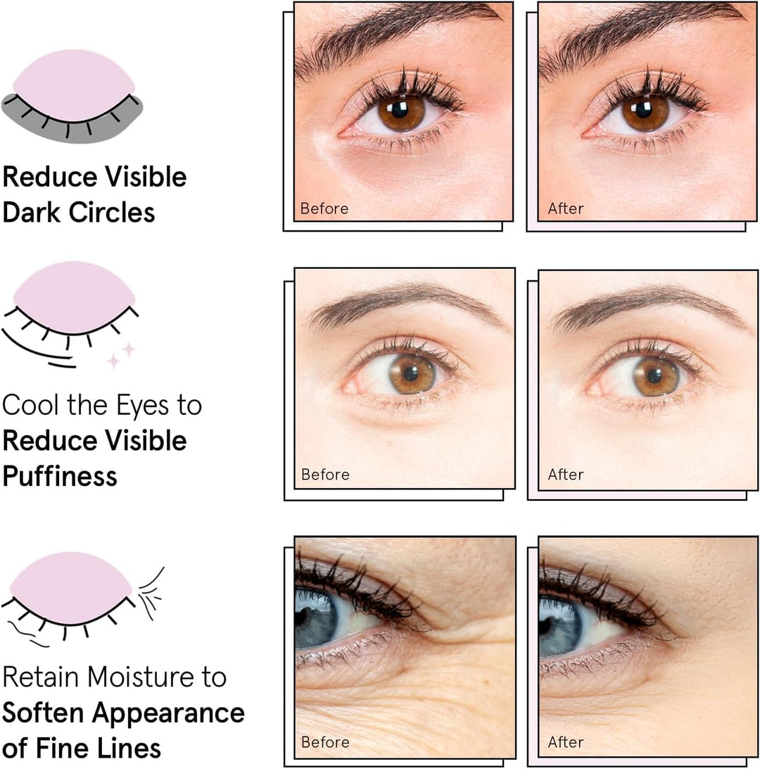 grace &amp; stella Award Winning Under Eye Mask - Birthday Gifts for Women - Gel Eye Patches for Dark Circles, Puffy Eyes, Undereye Bags - Mothers Day Gifts for Mom - Vegan Self Care (24 Pairs, Gold)