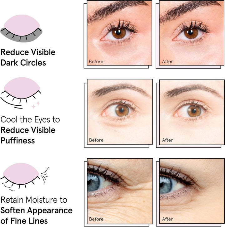 grace &amp; stella Award Winning Under Eye Mask - Birthday Gifts for Women - Gel Eye Patches for Dark Circles, Puffy Eyes, Undereye Bags - Mothers Day Gifts for Mom - Vegan Self Care (24 Pairs, Gold)