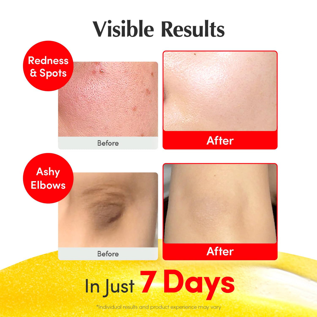 EQQUALBERRY Vitamin Illuminating Serum | Niacinamide 4% + Brightening Vitamin C Face Serum with Hyaluronic Acid &amp; Vitamin E | Dark Spot, Uneven Tone Care | Korean Skincare, 1.01 fl.oz