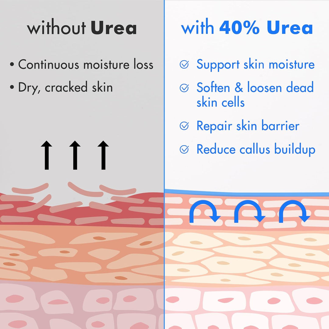 Ebanel Urea Cream 40% plus Salicylic Acid 2%, Foot Cream for Dry Cracked Heels Feet Knees Elbows Hands, Foot Dead Skin Cuticle Callus Remover Toenail Softener, Keratolytic Skin Barrier Repair