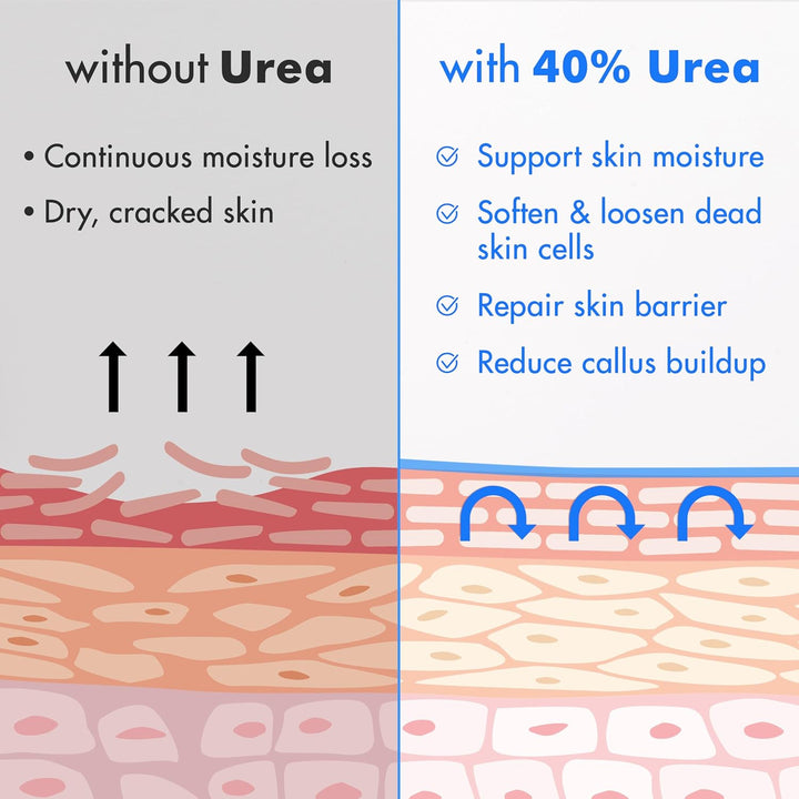 Ebanel Urea Cream 40% plus Salicylic Acid 2%, Foot Cream for Dry Cracked Heels Feet Knees Elbows Hands, Foot Dead Skin Cuticle Callus Remover Toenail Softener, Keratolytic Skin Barrier Repair
