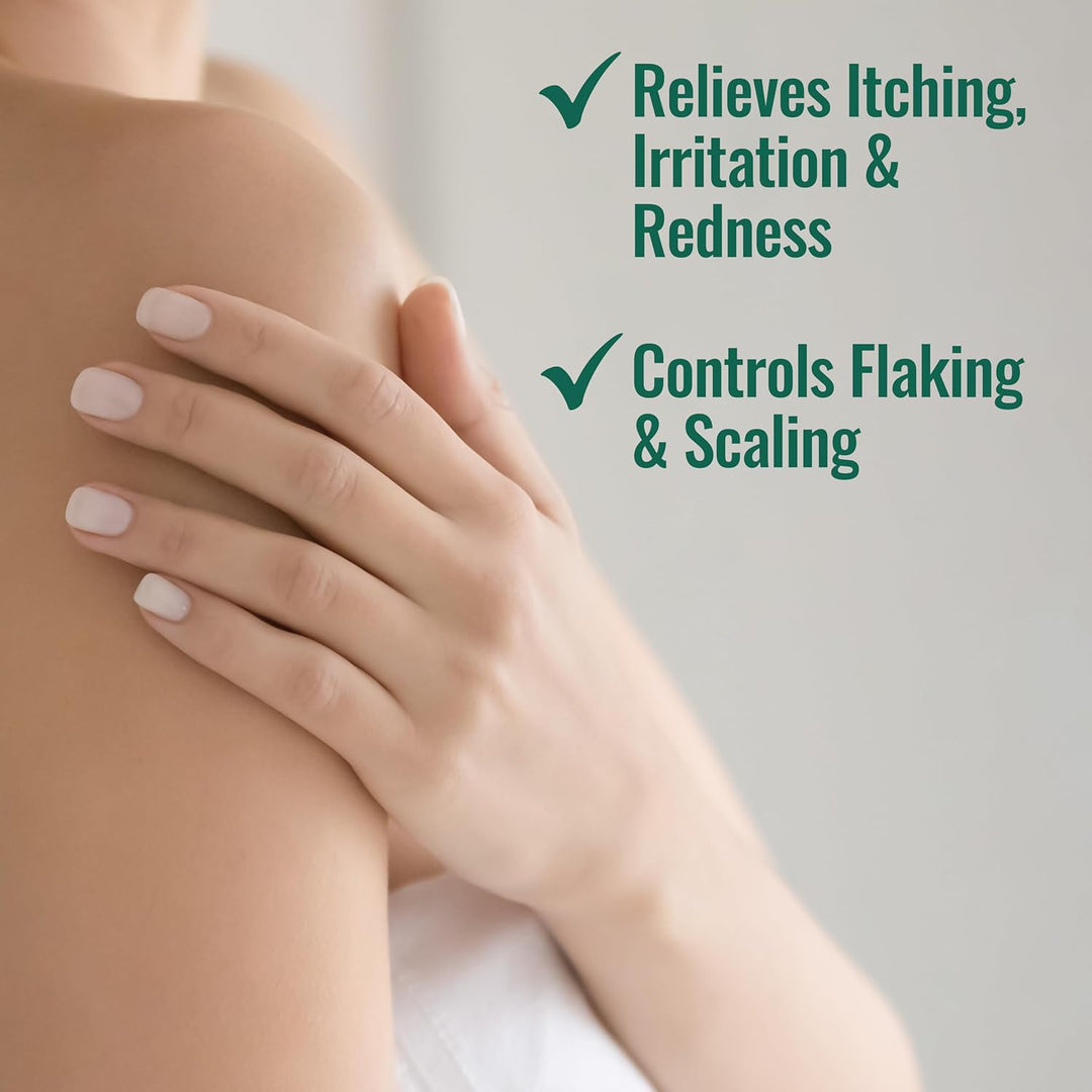 Nizoral Psoriasis Relief Cream- Relieves Itching, Irritation &amp; Redness and Controls Flaking and Scaling with Maximum Strength Medicine (Salicylic Acid 3%), 4 Fl Oz