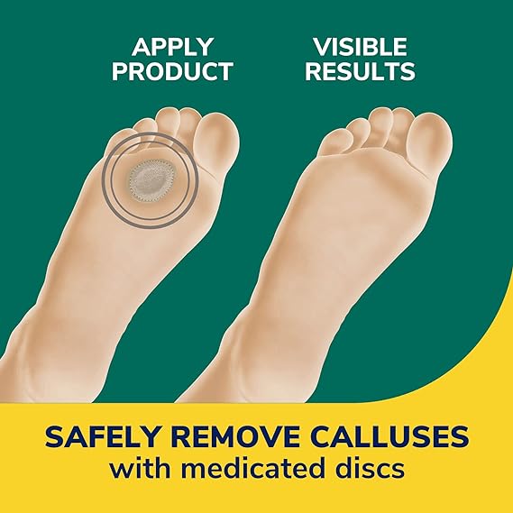 Dr. Scholl's Extra Thick Callus Remover, 4ct // Helps Soften Hard Calluses and Cushions for All-Day Pain Relief