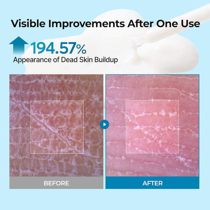 Dr.Melaxin Peel Shot Exfoliating TX Serum 80ml – 99% Pure Tranexamic Acid &amp; Niacinamide + AHA PHA Brightening Exfoliating for Uneven Skin Tone, Dark Spots &amp; Dullness | Smooth | Korean Skincare