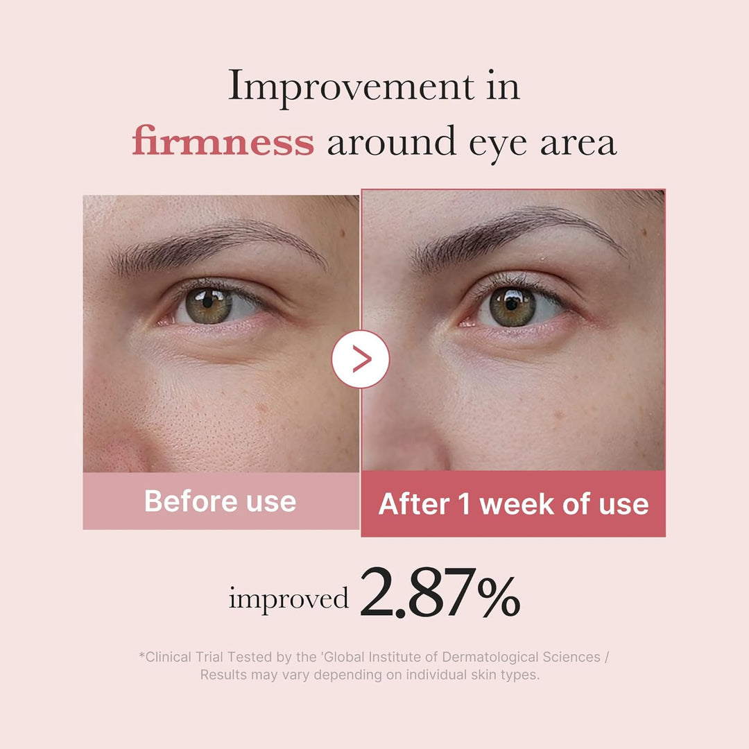 medicube Eye Serum with Salmon DNA PDRN &amp; Pink Peptides | 99% Purity Retinol for Fine Lines | PDRN &amp; Niacinamide for Uneven Skin Tone | Korean Skincare, 1.01 fl.oz