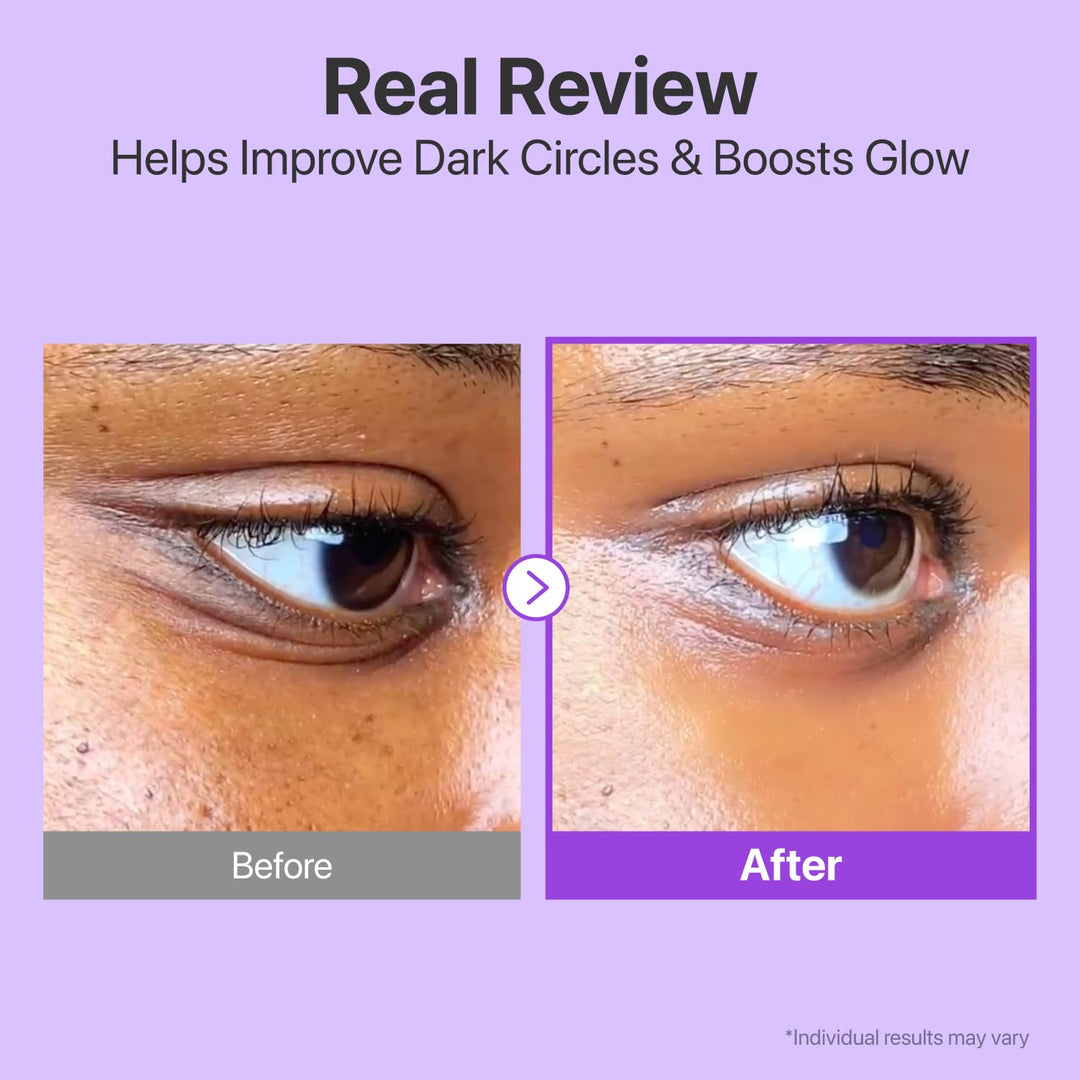 numbuzin No.9 NAD+ Retinol Eye Cream, Depuffing &amp; Firming Eye Serum for Dark Circles, Wrinkles &amp; Fine Lines, Peptides &amp; Niacinamide for Glow &amp; Undereye Radiance, Stocking Stuffers 0.33 fl oz