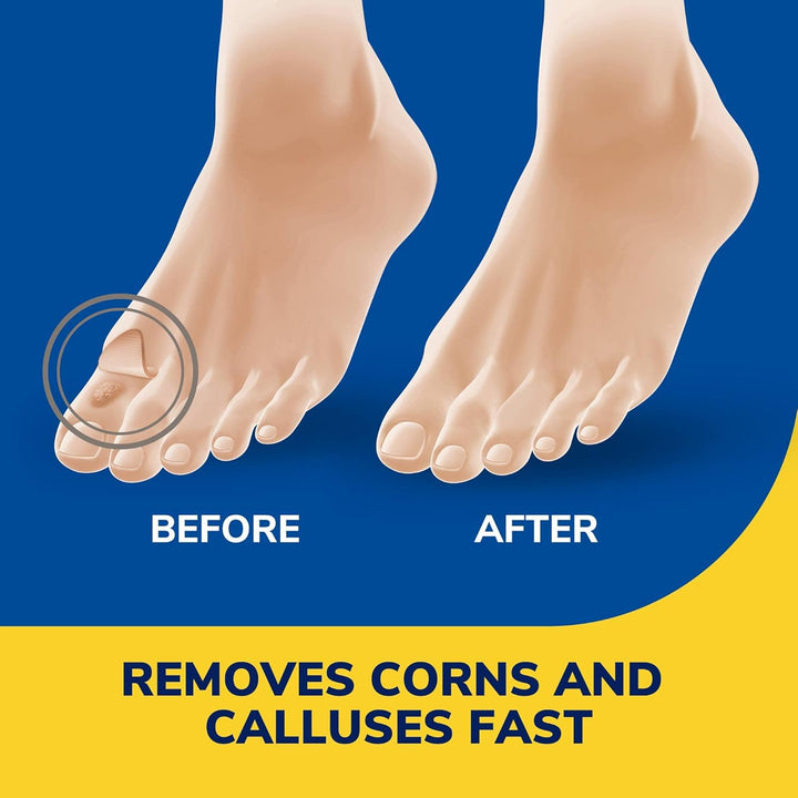 Scholl's Liquid Corn Callus Remover, Ounce // Removes