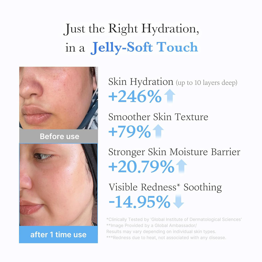 medicube Jelly Cream with Hyaluronic Acid | Daily Moisturizer for All Skin Types | Long-lasting Hydration with Hyaluronic Acid, Ceramides, Multi Peptides | Supports Skin&