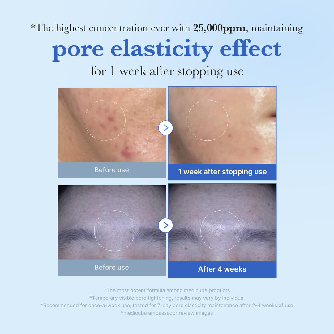 Medicube Exosome Shot Spicule Facial Serum |AHA+BHA+PHA |  Korean Skincare 30 ml