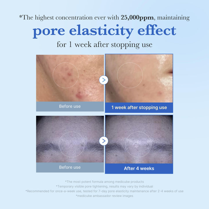 Medicube Exosome Shot Spicule Facial Serum |AHA+BHA+PHA |  Korean Skincare 30 ml