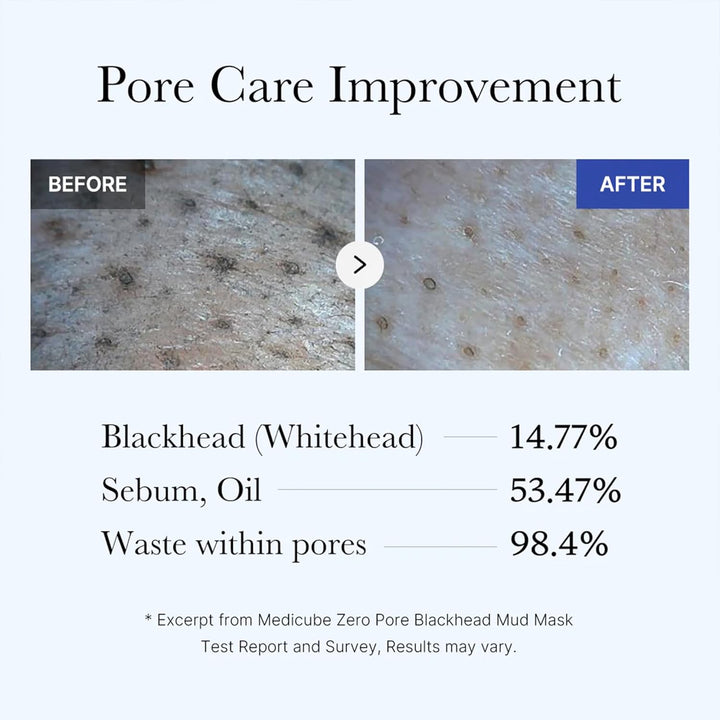 Medicube Zero Pore Blackhead Mud Facial Mask - Skin Cooling &amp; Pore Tightening - 3 Minute Quick Dry Formula with AHA, BHA, PHA, and Pore-Purifying Clay - Korean Mud Mask 3.52 oz