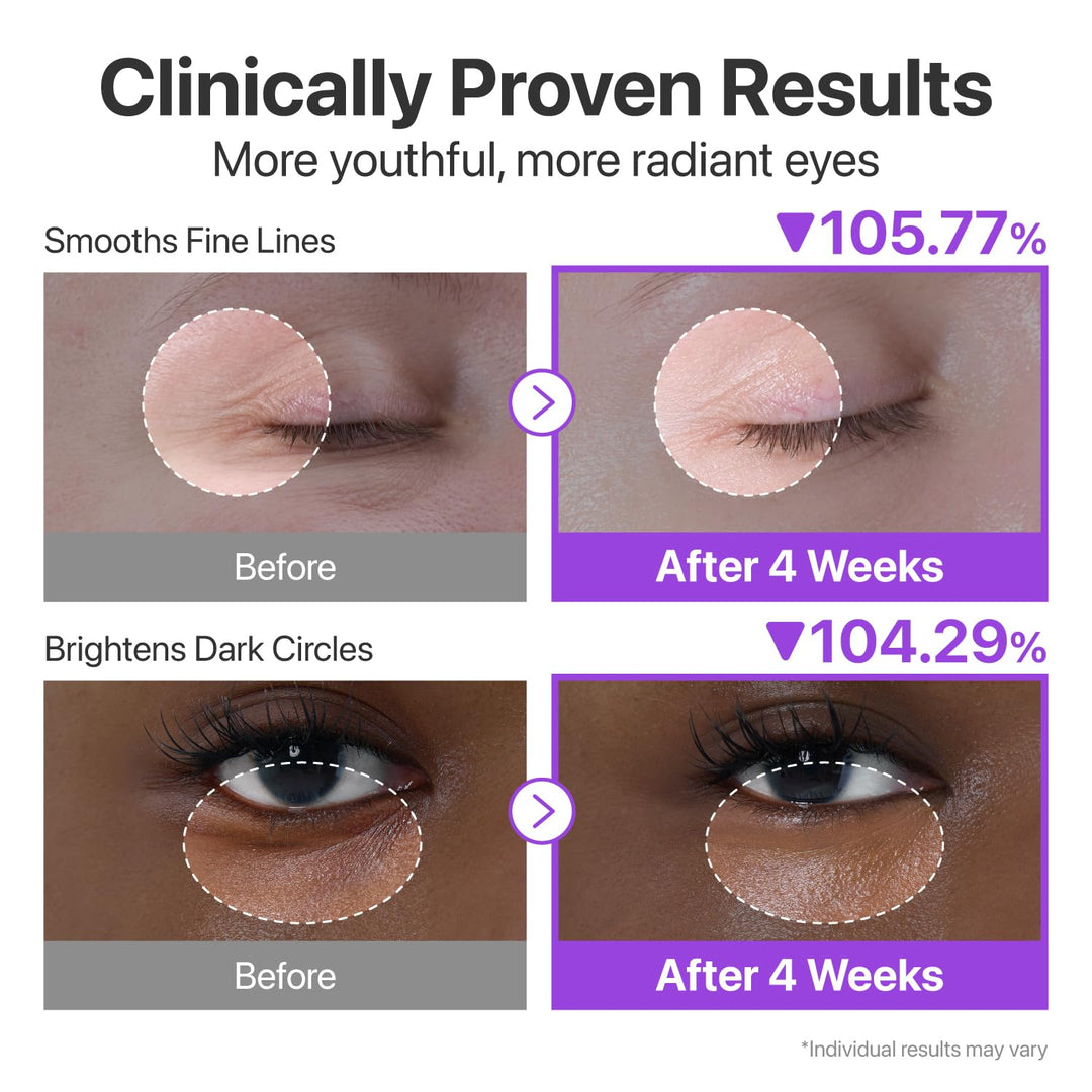 numbuzin No.9 NAD+ Retinol Eye Cream, Depuffing &amp; Firming Eye Serum for Dark Circles, Wrinkles &amp; Fine Lines, Peptides &amp; Niacinamide for Glow &amp; Undereye Radiance, Stocking Stuffers 0.33 fl oz