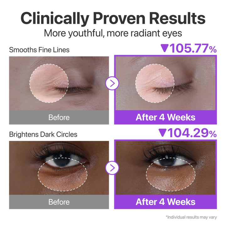 numbuzin No.9 NAD+ Retinol Eye Cream, Depuffing &amp; Firming Eye Serum for Dark Circles, Wrinkles &amp; Fine Lines, Peptides &amp; Niacinamide for Glow &amp; Undereye Radiance, Stocking Stuffers 0.33 fl oz