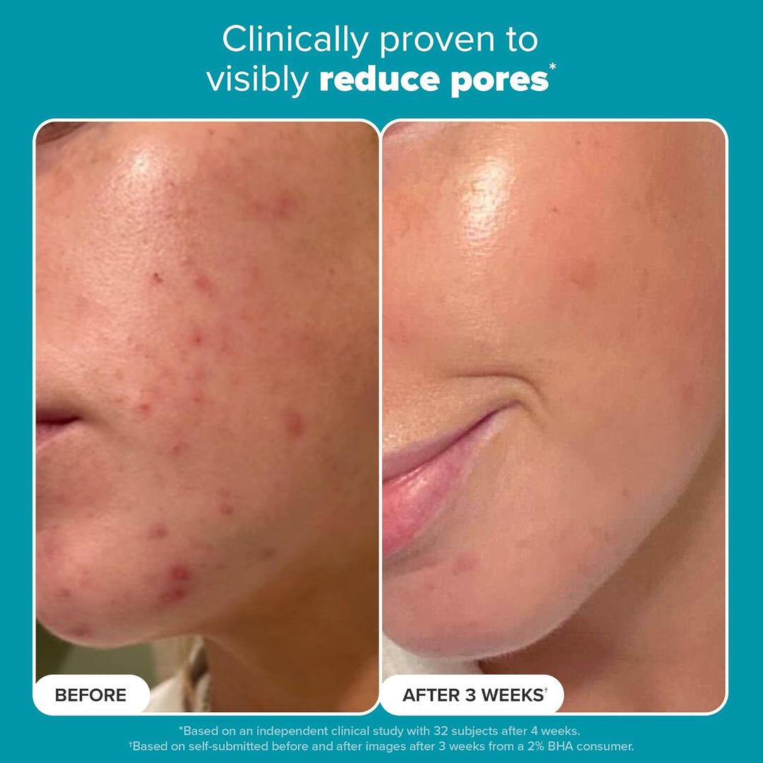 Paula's Choice SKIN PERFECTING 2% BHA Liquid Exfoliant Polish, Salicylic Acid Facial Exfoliator Polish for Enlarged Pores, Wrinkles & Fine Lines, Suitable for Blackhead-Prone Skin, Fragrance-Free