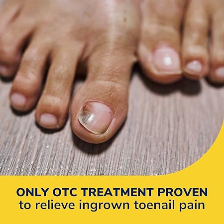 Dr. Scholl's Ingrown Toenail Pain Reliever, 0.3oz // Medicated Gel Softens Nails for Easy Trimming and Foam Ring and Bandage Protect the Affected Area White