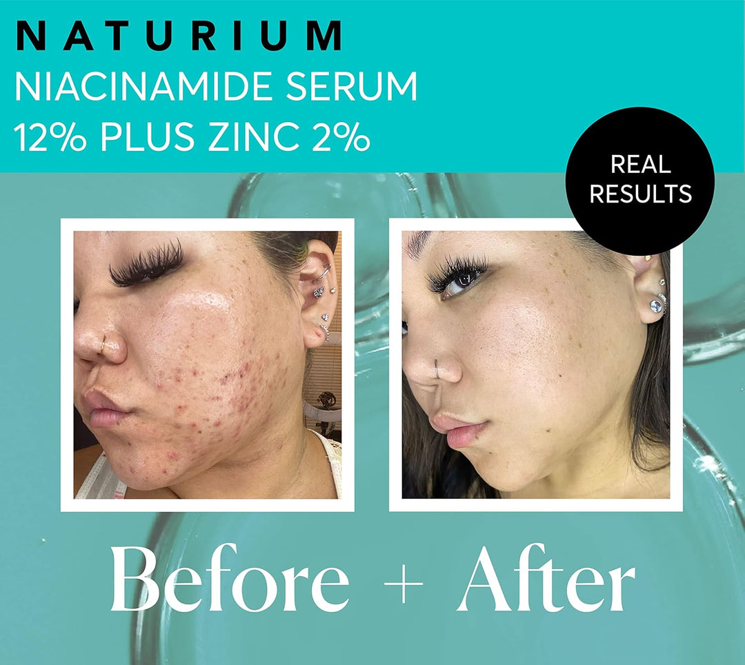 Naturium Niacinamide Face Serum 12% Plus Zinc 2%, Anti-Aging, Pore Minimizer &amp; Dark Spot Corrector with Hyaluronic Acid &amp; Vitamin E, Vegan &amp; Cruelty-Free, 1 oz