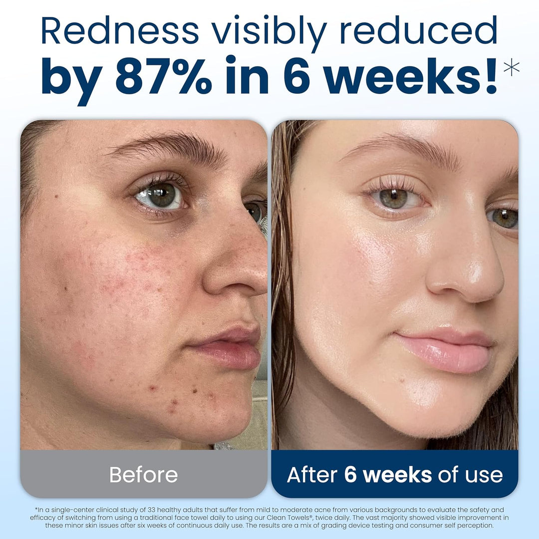 Clean Skin Club Clean Towels XL®, Travel Pack 100% USDA Biobased Disposable Face Towel, Eczema Association Accepted,Dry Wipes, TSA-Approved Travel Essential, 1 Pack, 10 ct Total