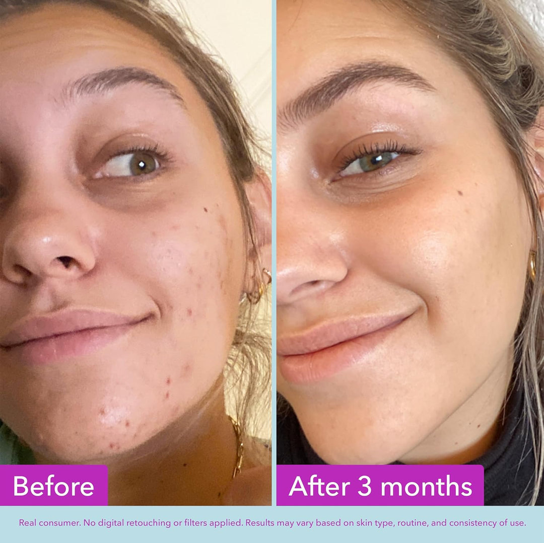 Good Molecules Niacinamide Brightening Toner - Toner for Face with Niacinamide and Arbutin for Skin Tone Balancing- Pore Minimizer, Skin Care for Face