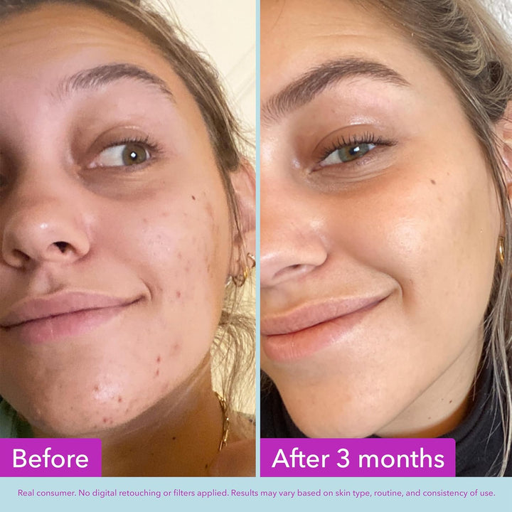 Good Molecules Niacinamide Brightening Toner - Toner for Face with Niacinamide and Arbutin for Skin Tone Balancing- Pore Minimizer, Skin Care for Face