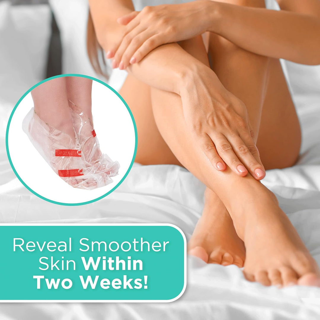 DERMORA Foot Peel Mask | Skin Exfoliating Foot Masks for Dry, Cracked Feet &amp; Callus Removal | Dead Skin Exfoliator for Baby Soft Feet | Pack of 2 | Regular (Fits up to Men 10 / Women 11) | Original
