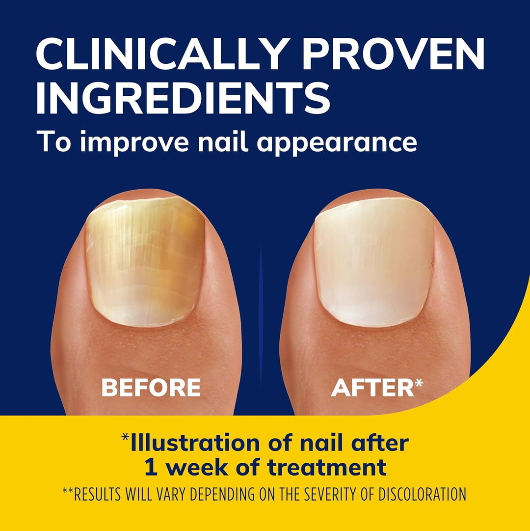 Dr. Scholl's Fungal Nail Treatment Revitalizer LED Light-Activated Therapy, Erase Toenail Discoloration Fungus, 10 ml