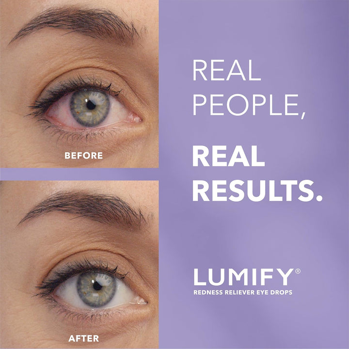 LUMIFY Eye Drops for Red Eyes, Redness Reliever for Brighter Looking Eyes, Works in 1 Minute &amp; Lasts Up to 8 Hours, Eye Drops, 0.08 Fl Oz (2.5 mL)