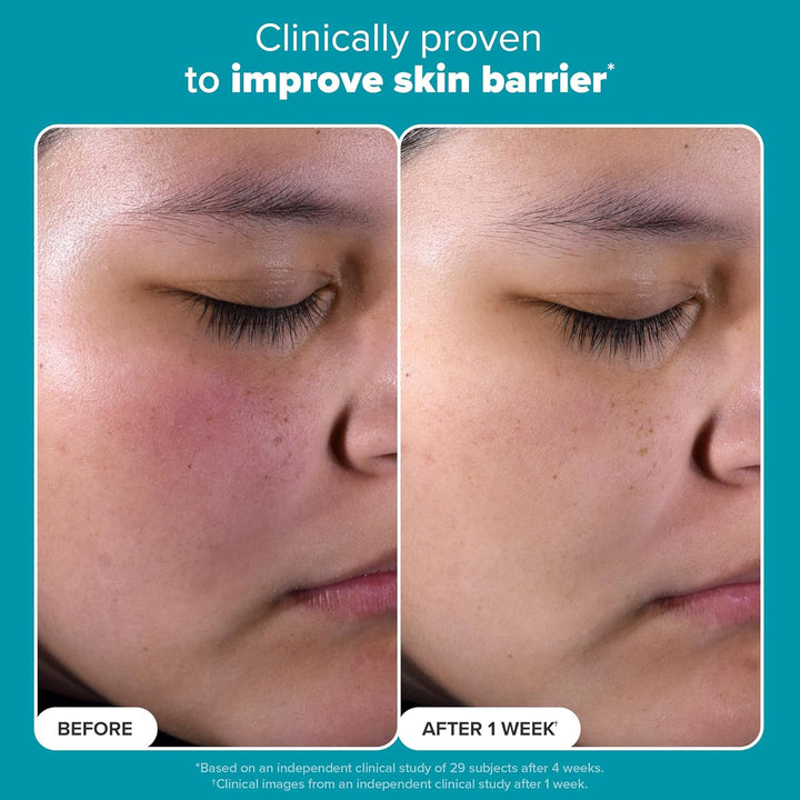 Paula's Choice Skin Perfecting 2% BHA Liquid Salicylic Acid Exfoliant, Gentle Facial Exfoliator for Blackheads, Large Pores, Wrinkles & Fine Lines