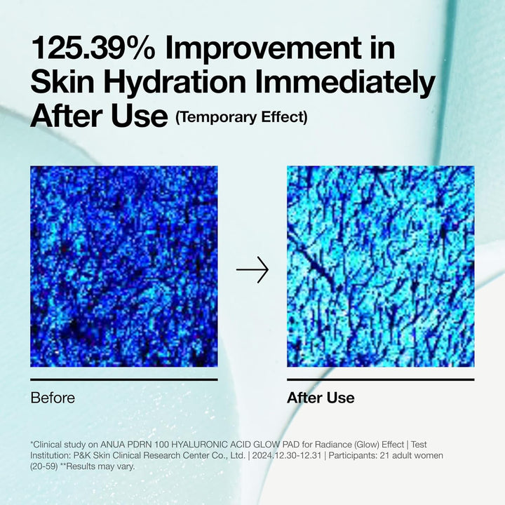 ANUA PDRN 100 Hyaluronic Acid Pad, Glow-Plumping Korean Face Pad for Daily Skincare &amp; Makeup Prep, Dual-Sided Toner for Radiant Skin &amp; Deep Hydration, Korean Skin Care (180ml, 60 Pads)