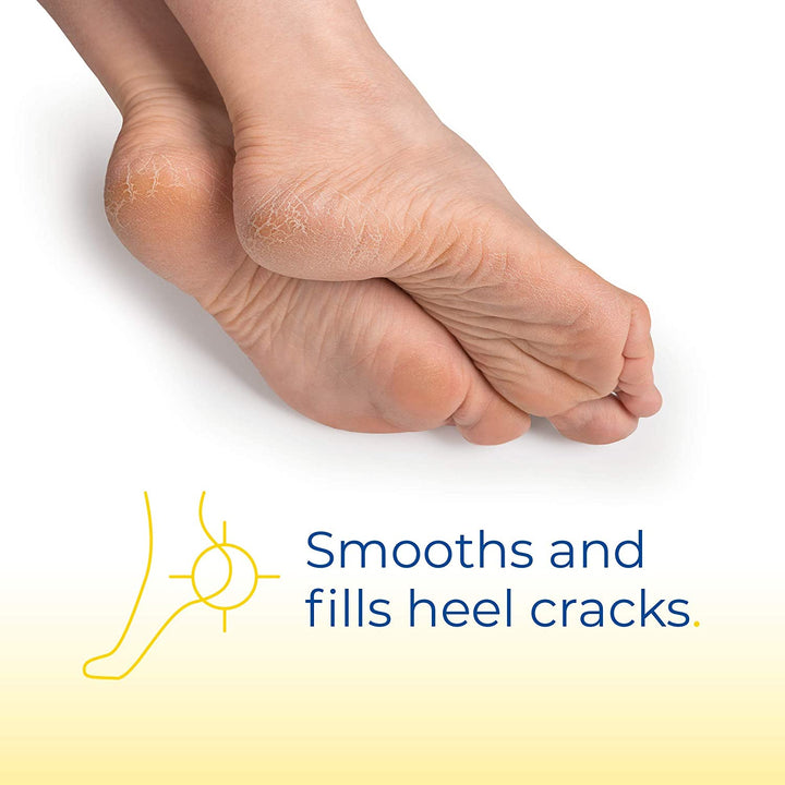 Dr. Scholl's Severe Cracked Heel Repair Restoring Balm 2.5oz, with 25% Urea for Dry, Cracked Feet, Heals and Moisturizes for Healthy Feet - 3alababak